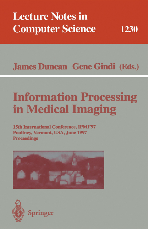 Information Processing in Medical Imaging - 