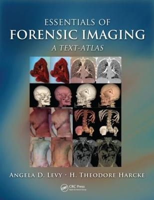 Essentials of Forensic Imaging - Angela D. Levy, H. Theodore Harcke Jr.