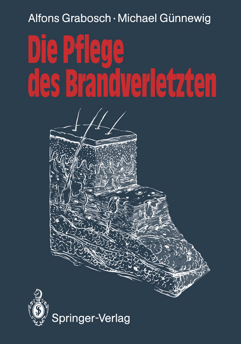 Die Pflege des Brandverletzten - Alfons Grabosch, Michael Günnewig