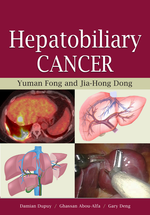 Hepatobiliary Cancer -  Yuman Fong