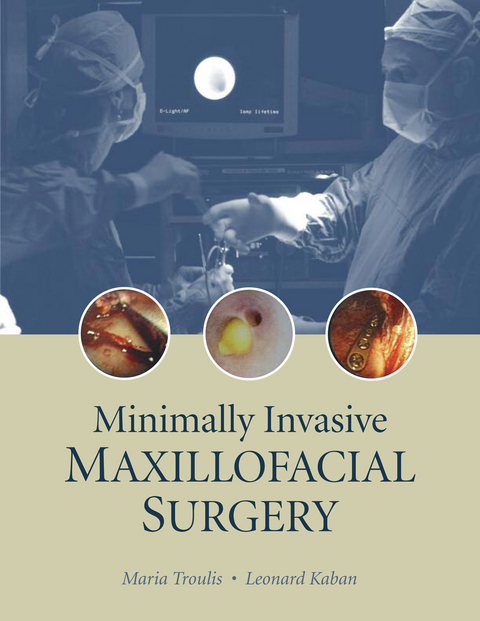 Minimally Invasive Maxillofacial Surgery -  Leonard Kaban,  Maria Troulis