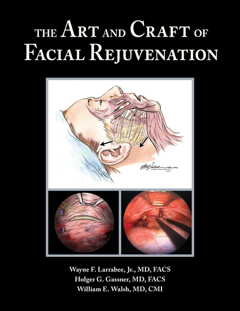 The Art and Craft of Facial Rejuvenation - Wayne Larrabee, Holger Gassner, William Walsh