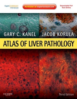 Atlas of Liver Pathology - Gary C. Kanel, Jacob Korula