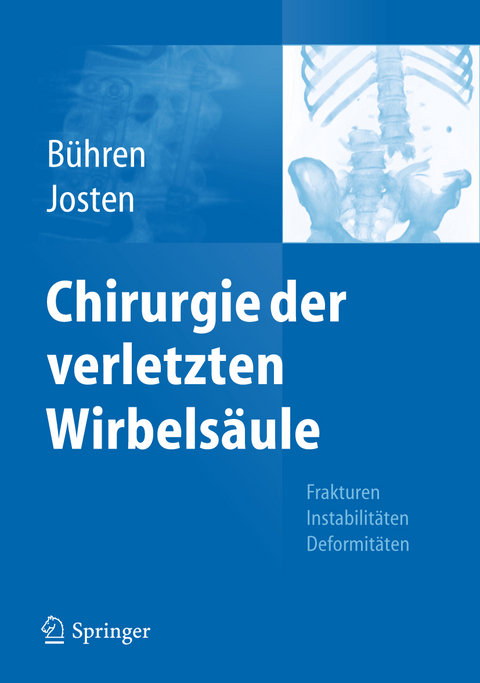 Chirurgie der verletzten Wirbelsäule - 