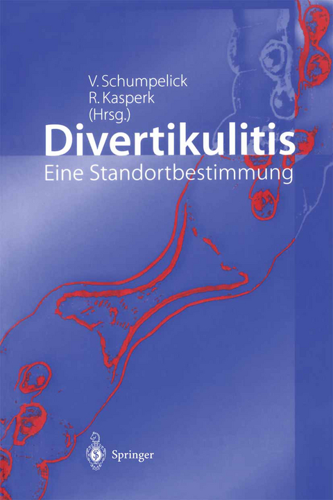 Divertikulitis - 