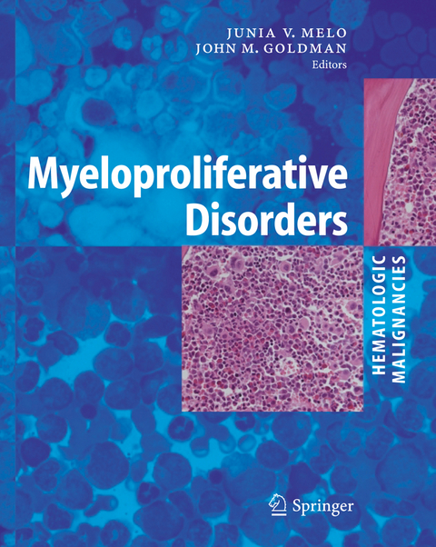 Myeloproliferative Disorders - 