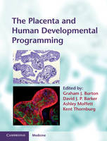 The Placenta and Human Developmental Programming - 