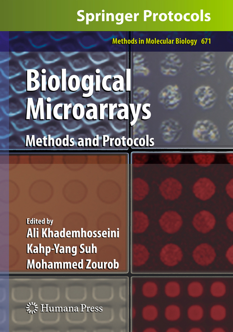 Biological Microarrays - 