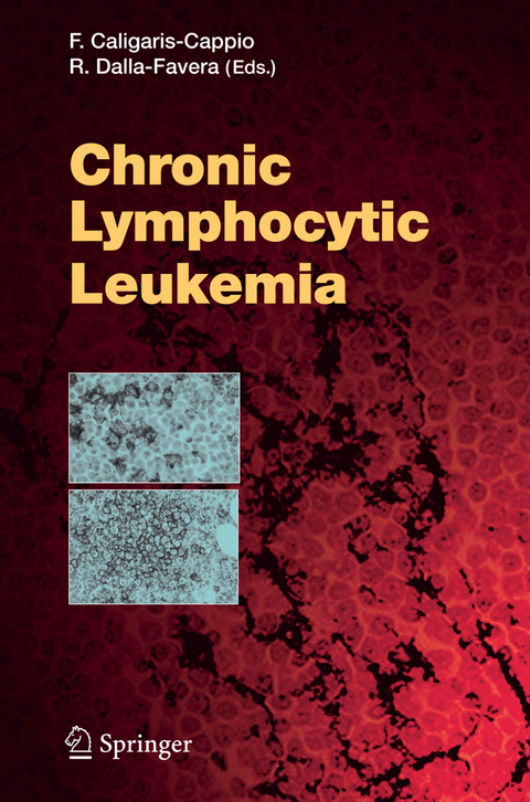 Chronic Lymphocytic Leukemia