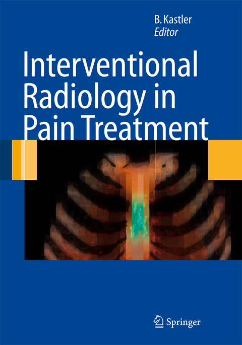 Interventional Radiology in Pain Treatment - 