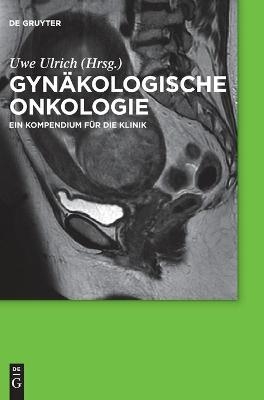 Gynäkologische Onkologie - 