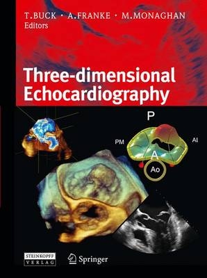 3D-echocardiography - 