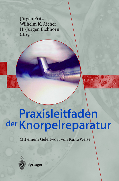 Praxisleitfaden der Knorpelreparatur - 