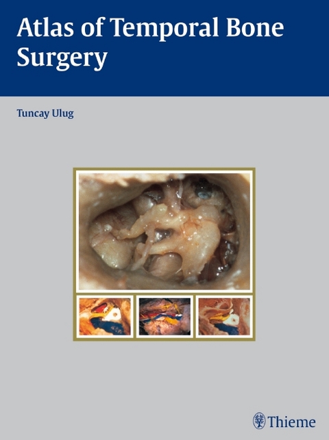 Atlas of Temporal Bone Surgery - Tuncay Ulug