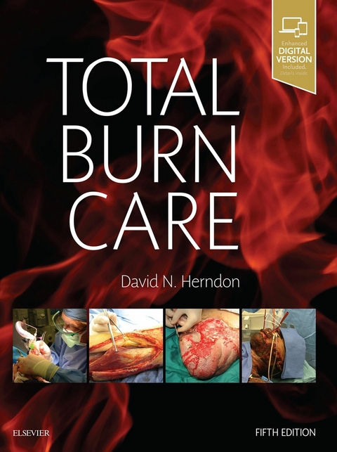 Total Burn Care E-Book -  David N. Herndon