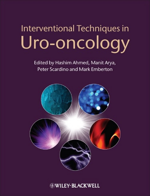 Interventional Techniques in Uro-oncology - 