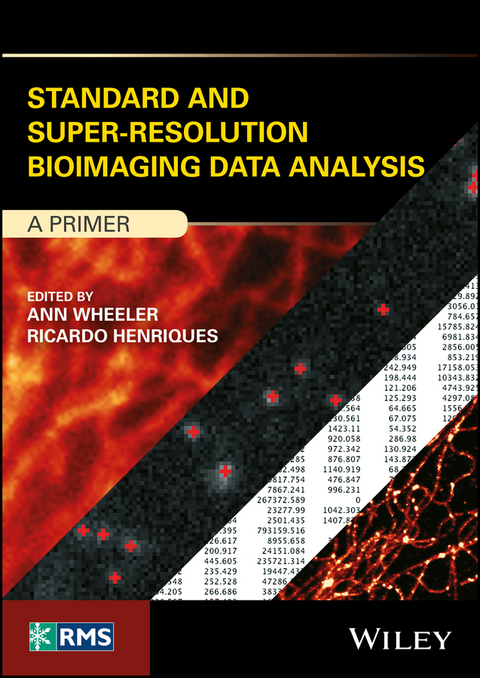 Standard and Super-Resolution Bioimaging Data Analysis - 