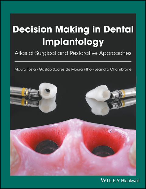 Decision Making in Dental Implantology - Mauro Tosta, Gastão Soares de Moura Filho, Leandro Chambrone