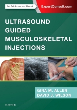 Ultrasound Guided Musculoskeletal Injections E-Book -  Gina M Allen,  David John Wilson