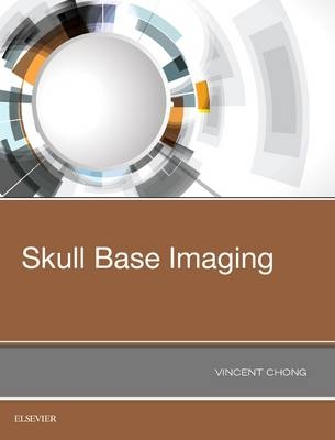 Skull Base Imaging -  Vincent Chong