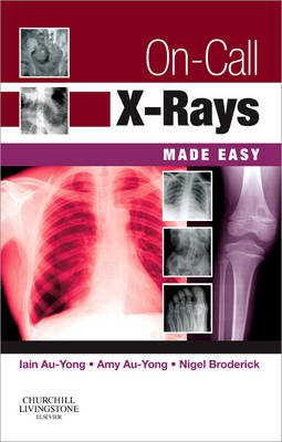 On-Call X-Rays Made Easy - Iain Au-Yong, Amy Au-Yong, Nigel Broderick