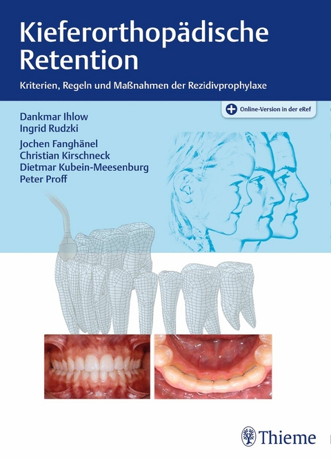 Kieferorthopädische Retention - 