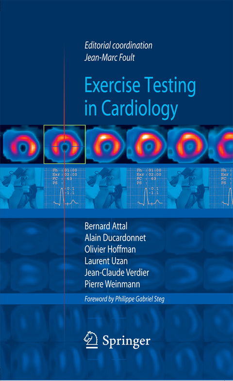 Exercise testing in cardiology - 