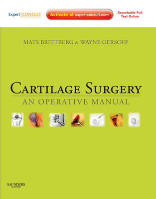 Cartilage Surgery - Mats Brittberg, Wayne Gersoff