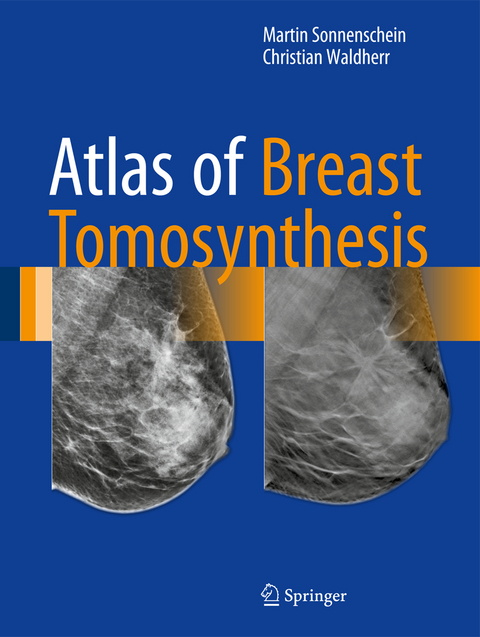 Atlas of Breast Tomosynthesis - Martin Sonnenschein, Christian Waldherr