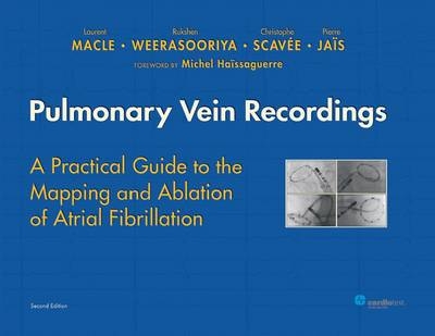 Pulmonary Vein Recordings - Laurent Macle