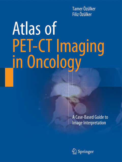 Atlas of PET-CT Imaging in Oncology - Tamer Özülker, Filiz Özülker