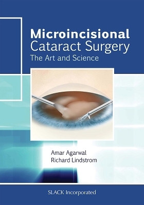 Microincisional Cataract Surgery - Amar Agarwal, Richard L. Lindstrom