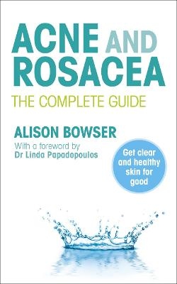 Acne and Rosacea - Alison Bowser