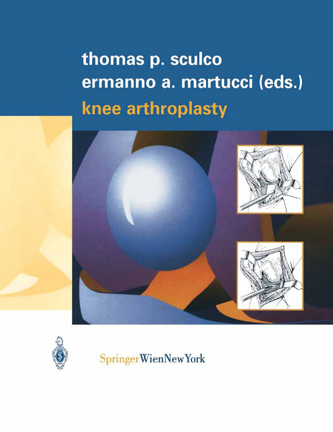 Knee Arthroplasty - 