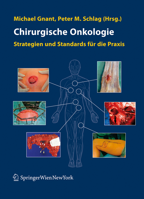 Chirurgische Onkologie - 