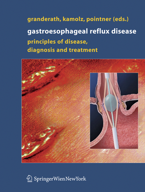 Gastroesophageal Reflux Disease - 