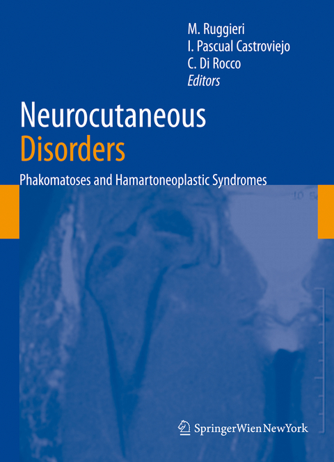 Neurocutaneous Disorders - 