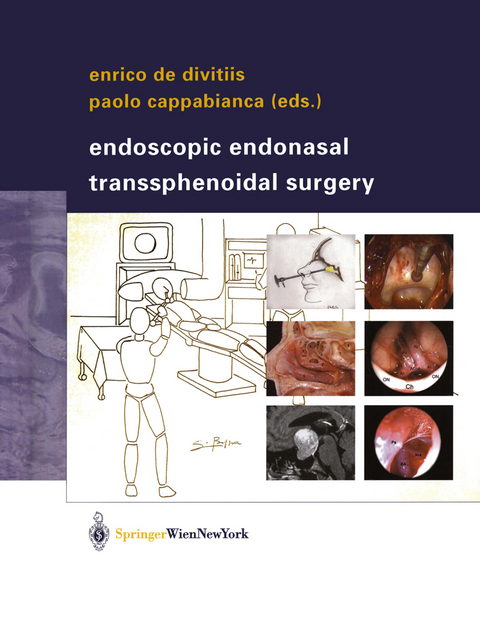 Endoscopic Endonasal Transsphenoidal Surgery - 