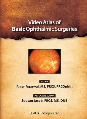 Video Atlas of Basic Ophthalmic Surgeries - Amar Agarwal