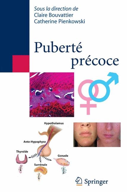 Puberte Precoce