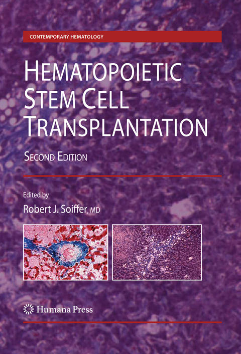 Hematopoietic Stem Cell Transplantation - 