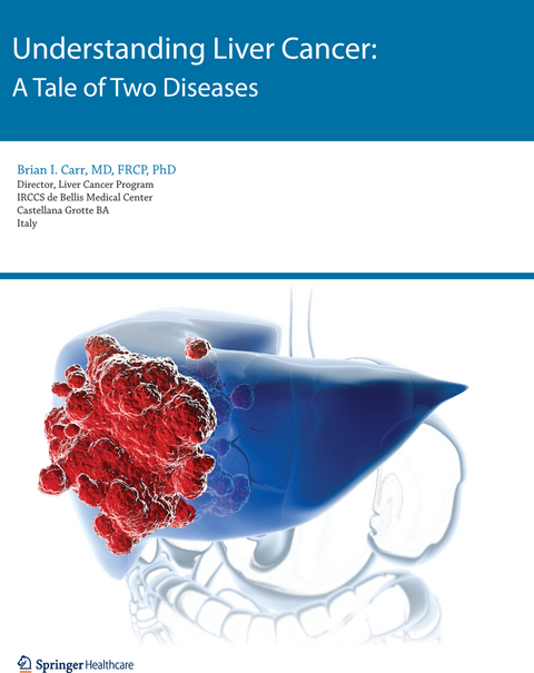 Understanding Liver Cancer - Brian I. Carr