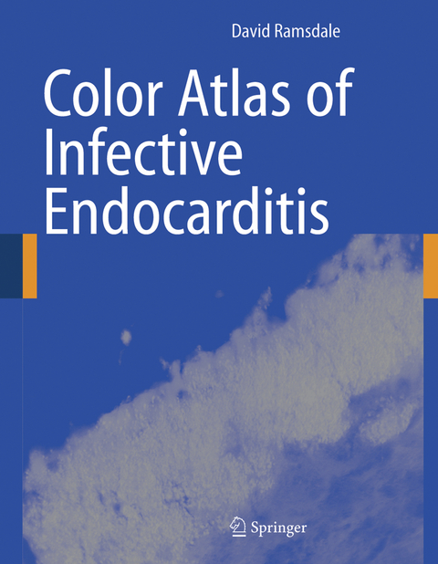 Color Atlas of Infective Endocarditis - David R. Ramsdale