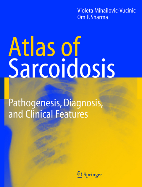 Atlas of Sarcoidosis - Violeta Mihailovic-Vucinic, Om P. Sharma