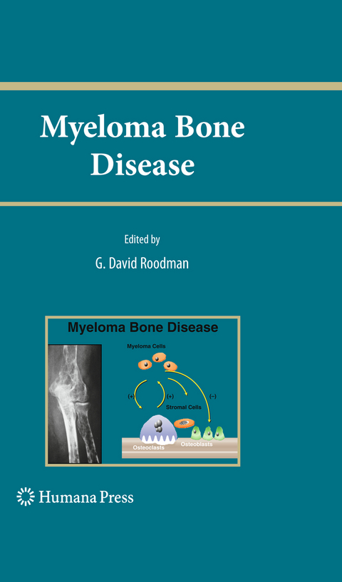 Myeloma Bone Disease - 