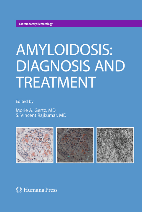 Amyloidosis - 