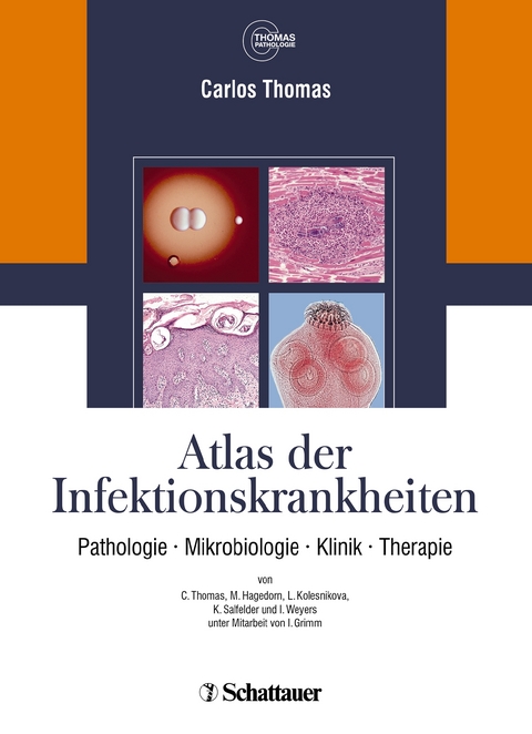 Atlas der Infektionskrankheiten - Carlos Thomas, Annette Cecetka-Thomas, Renate Woicichowski