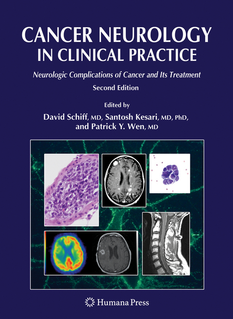 Cancer Neurology in Clinical Practice - 