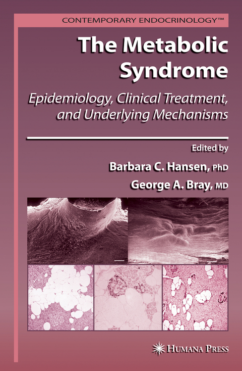 The Metabolic Syndrome: - 