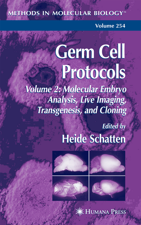 Germ Cell Protocols - 